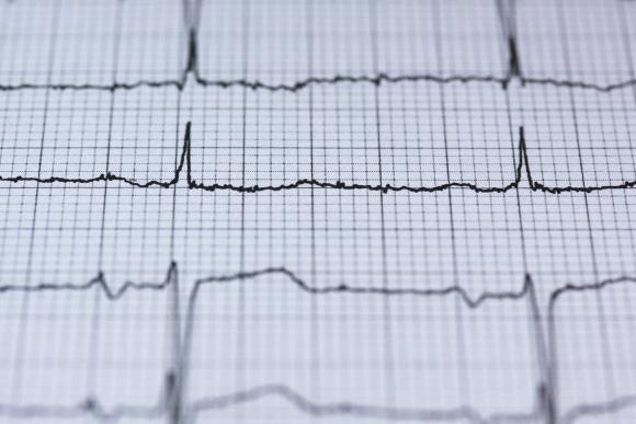 Le moratoire sur les maisons médicales est levé !