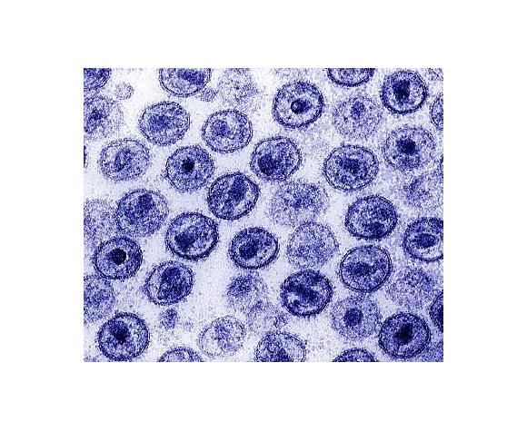 Remboursement de l'anti-sida d'urgence